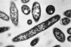 First death reported in Legionnaires' disease outbreak in New York City