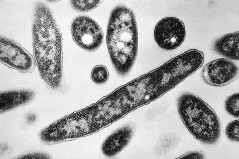 First death reported in Legionnaires' disease outbreak in New York City