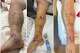 Chris Howarth recibió decenas de viales de antídoto en el Hospital Oroville.
