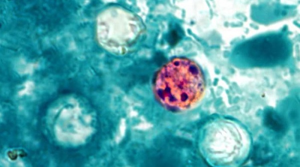 Texas reports 48 cyclospora cases as cryptosporidium surfaces in Bexar County