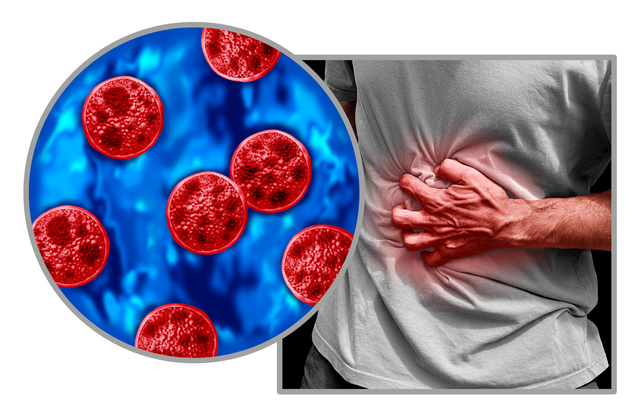 Texas reports 68 cyclosporiasis cases as experts urge produce safety precautions