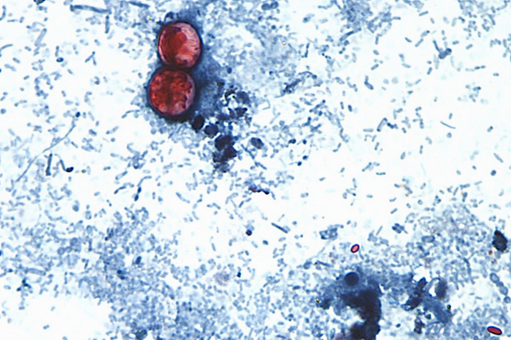 Brote de cyclospora por lechuga en EEUU expone la caída de inspecciones de la FDA