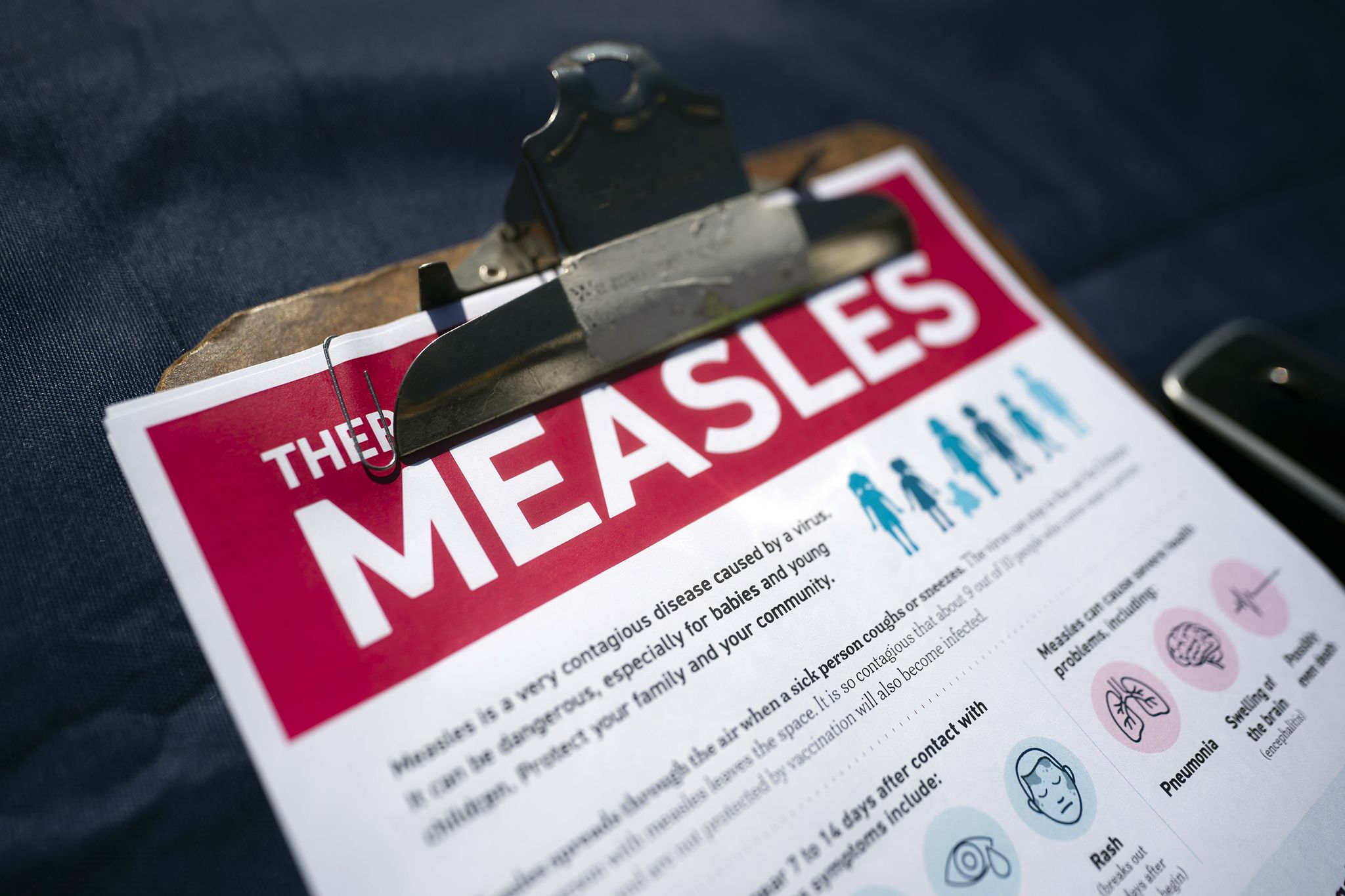 Californians warned of potential measles exposure by traveler in 6 counties