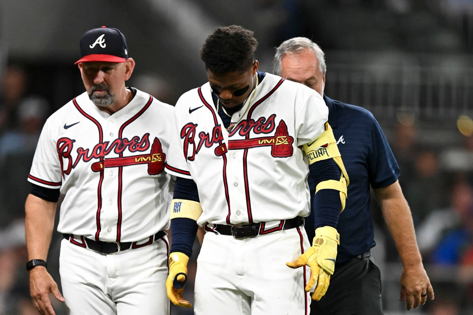 Braves' star Acuña day-to-day after fouling ball off left leg