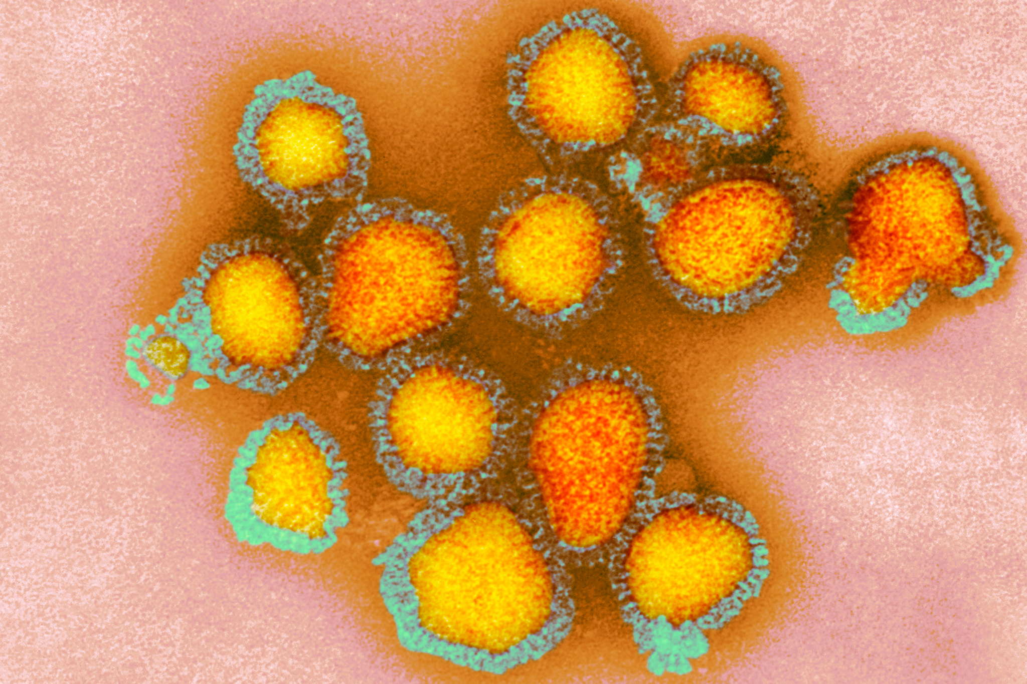 'Game on': Bay Area now epicenter of California flu cases
