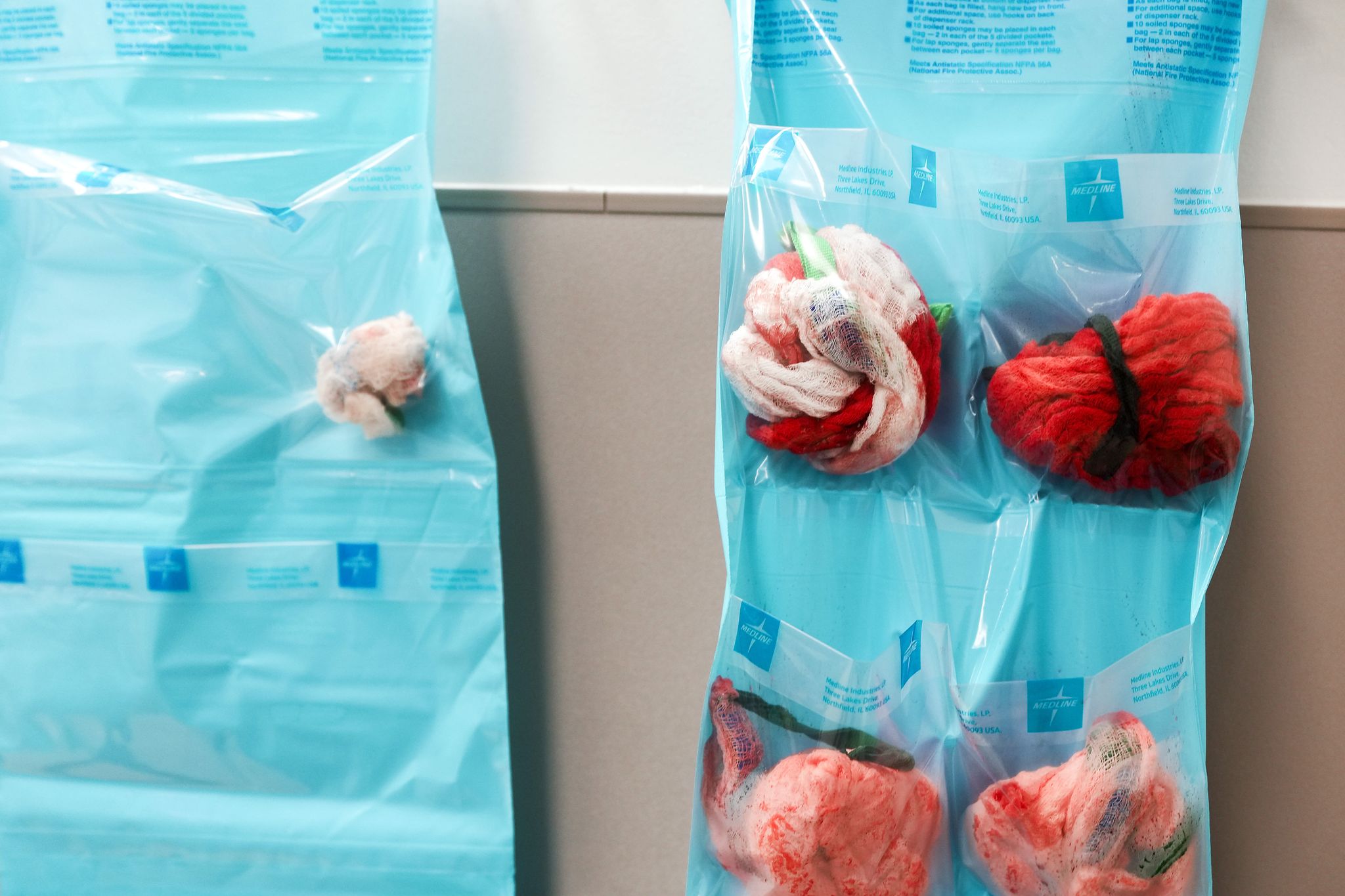 Three takeaways from our investigation into extreme surgery errors