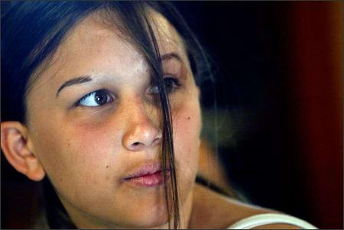 The scars from Lisa Williamson's burn are far less visible six years after she came to Camp Eyabsut for the first time. Lisa is now 17; her 2006 visit to the camp was her last.