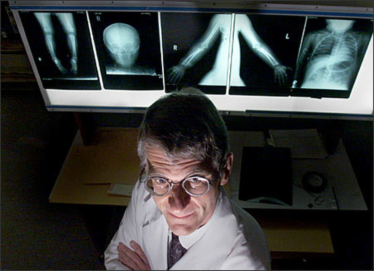 Dr. Richard Harruff, King County's chief medical examiner, with X-rays of a young child who died. Under state law, only the six largest counties in the state, out of 39, can hire medical examiners; the rest must use coroners.