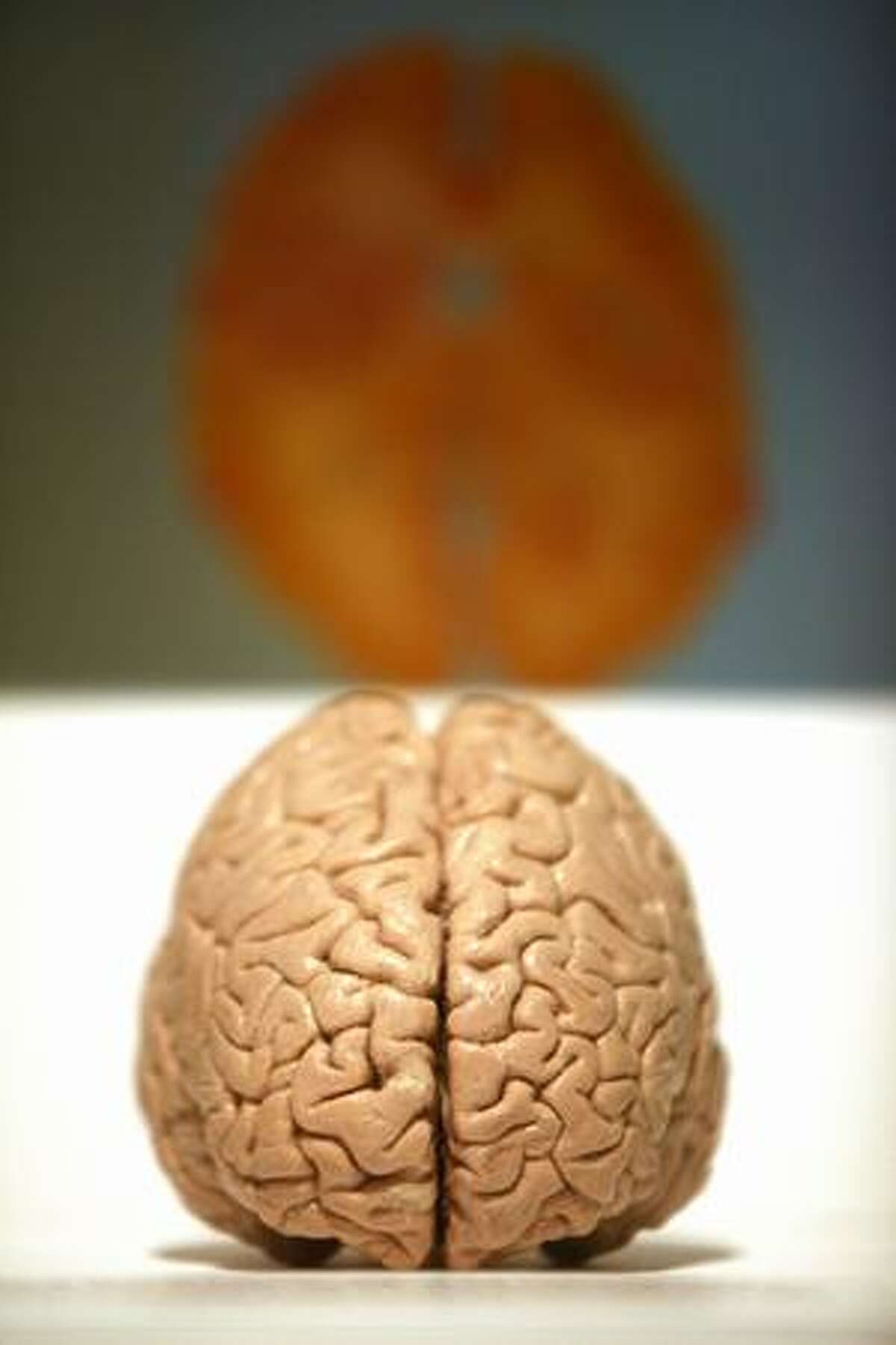 A brain is shown in "Bodies...The Exhibition" during a media preview on Thursday in downtown Seattle.