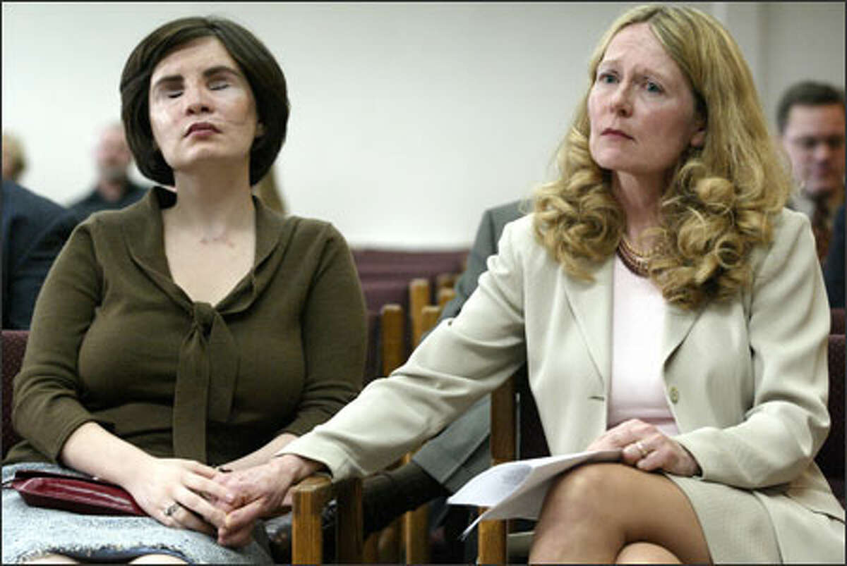 Maria Federici and her mother, Robin Abel, listen to debate after Abel testified in favor of Senate Bill 5457 before the state Senate Judiciary Committee. The bill would create criminal penalties for driving with an unsecured load. Federici wsa blinded and disfigured by a sheet of plywood that crashed through her windshield as she drove on Interstate 405.