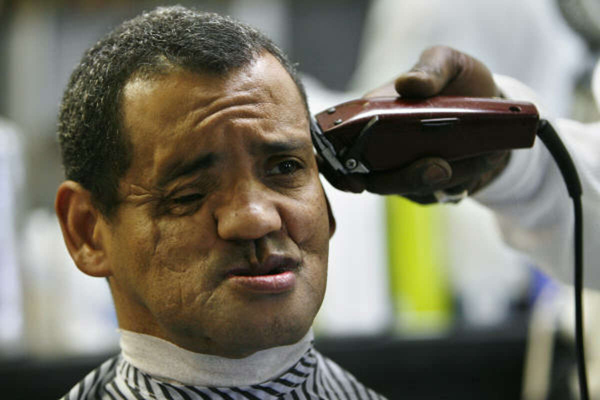 Before meeting with the surgeon who will lead the effort to reconstruct his face, Ricardo Rachell gets his first haircut as a free man Tuesday. Rachell's face was damaged by a shotgun blast in 1992.