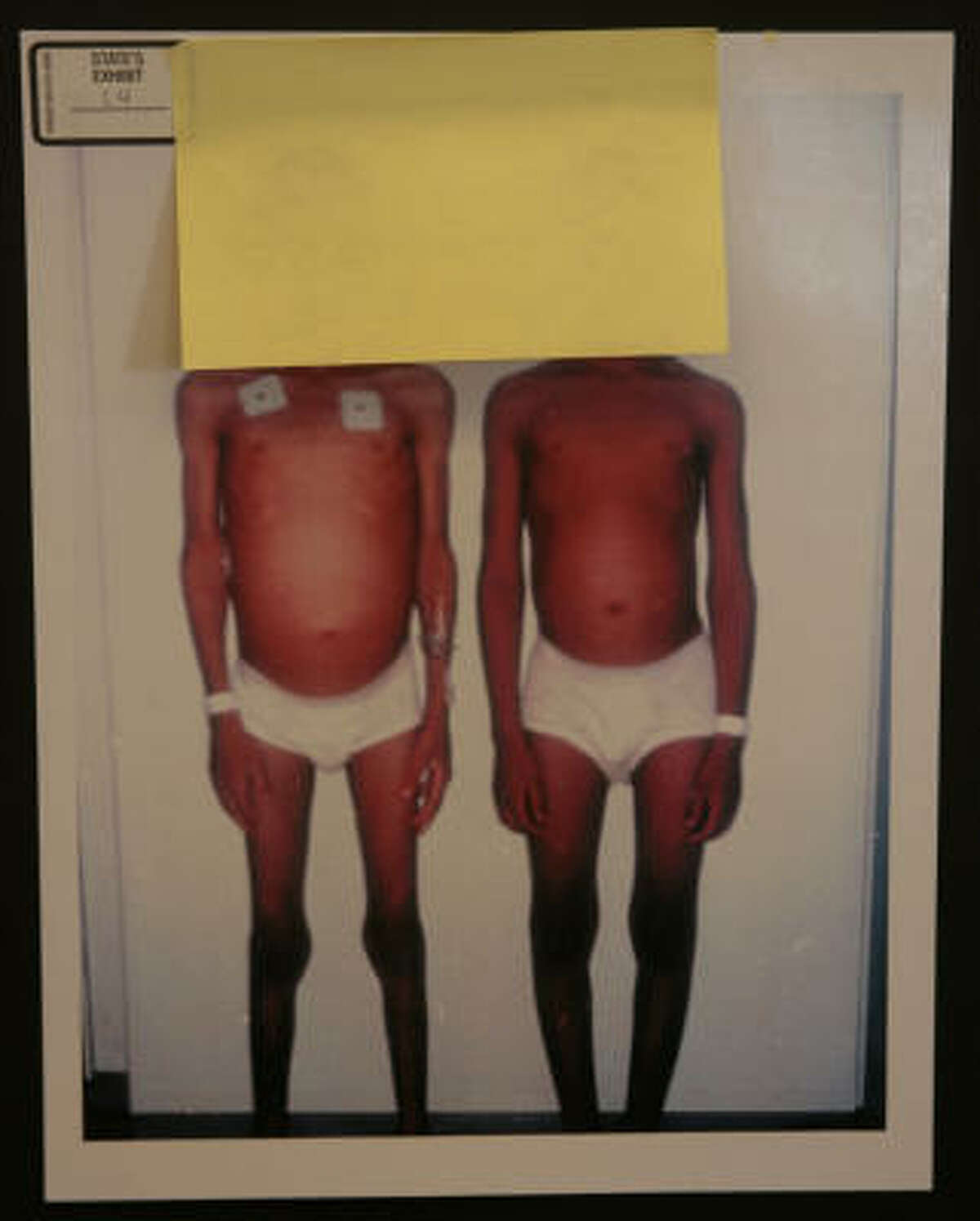 Evidence photos show the emaciated condition of the two brothers.