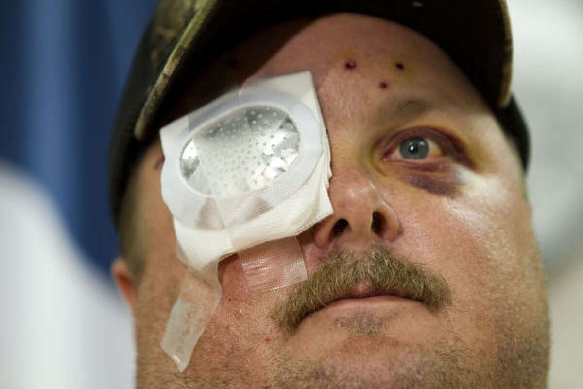 Conroe officer who lost eye in shooting still has his job (w/videos) pic pic photo