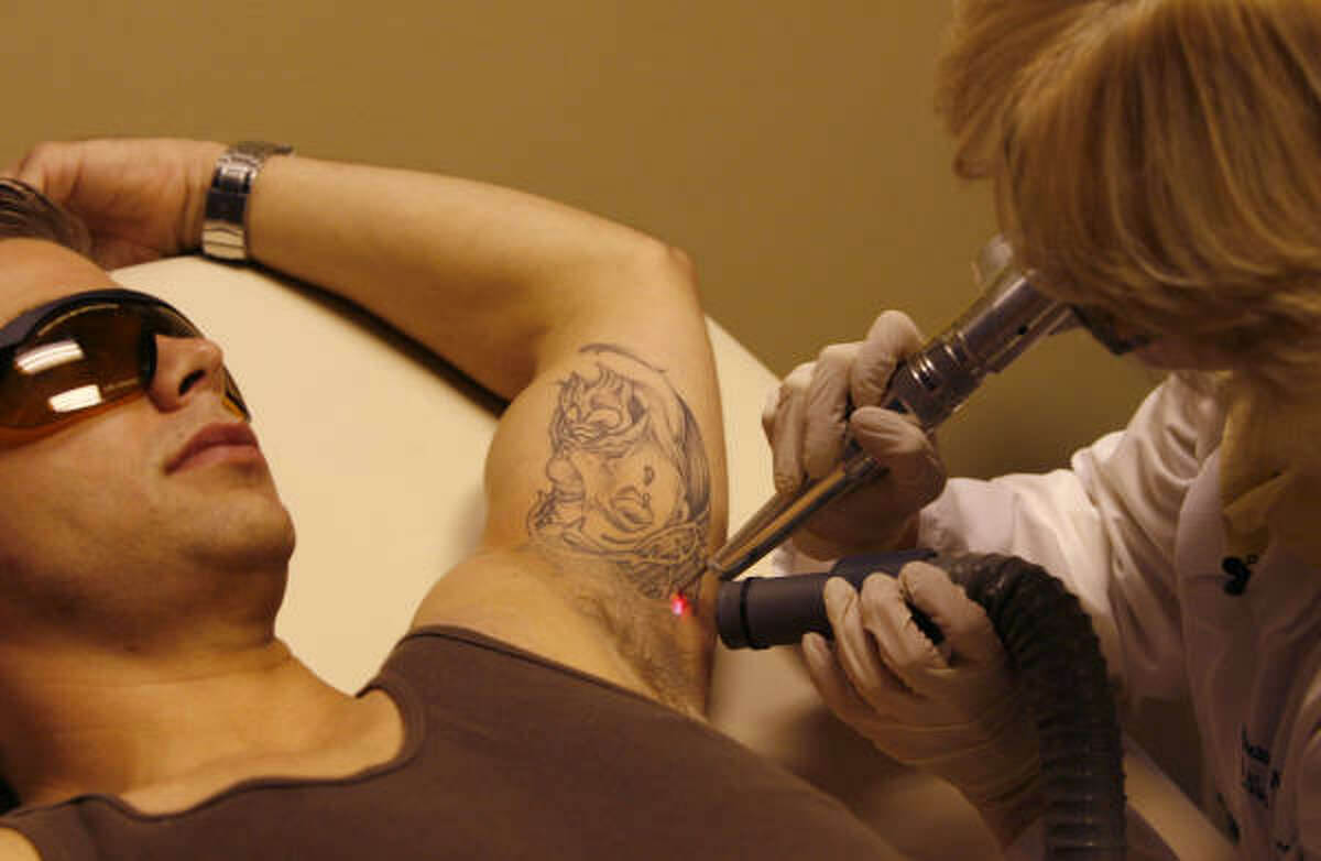 Tattoo removal makes mark in slow economy