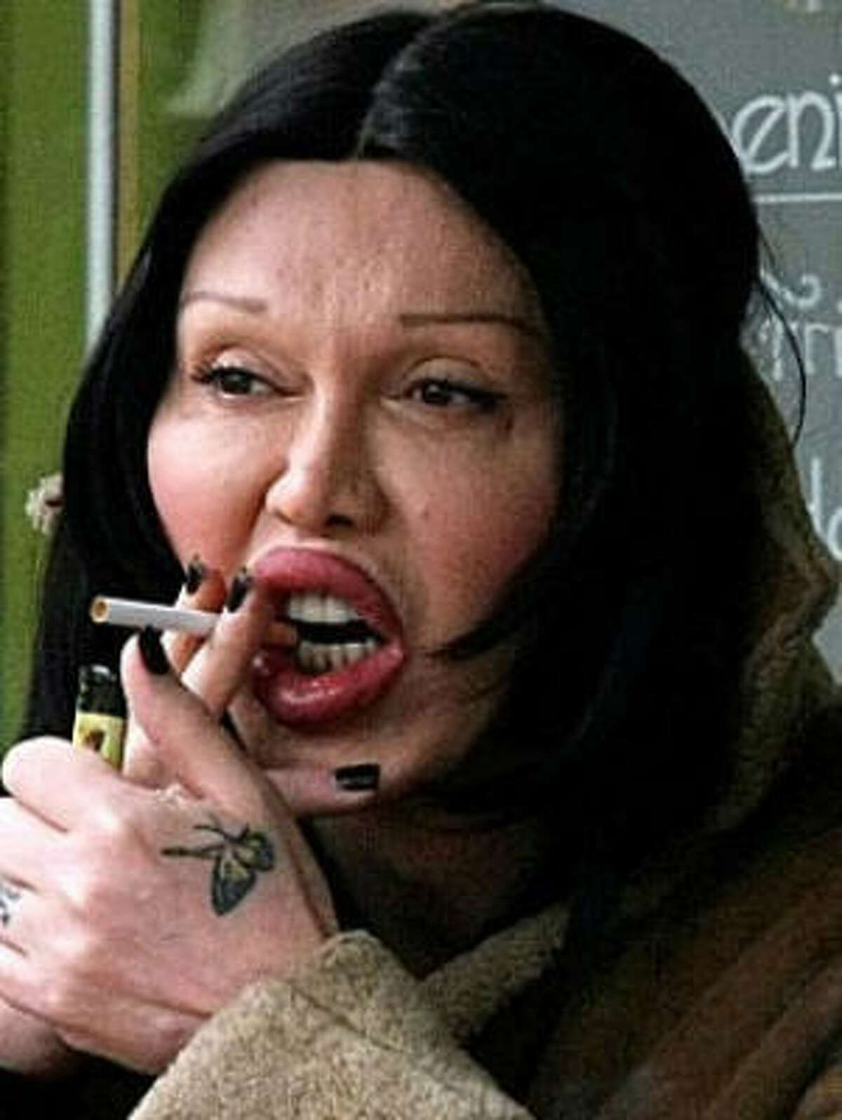 '80s singer Pete Burns won his medical malpractice lawsuit against the doctor who injected his lips with collagen. But he seems to have done a lot more since.