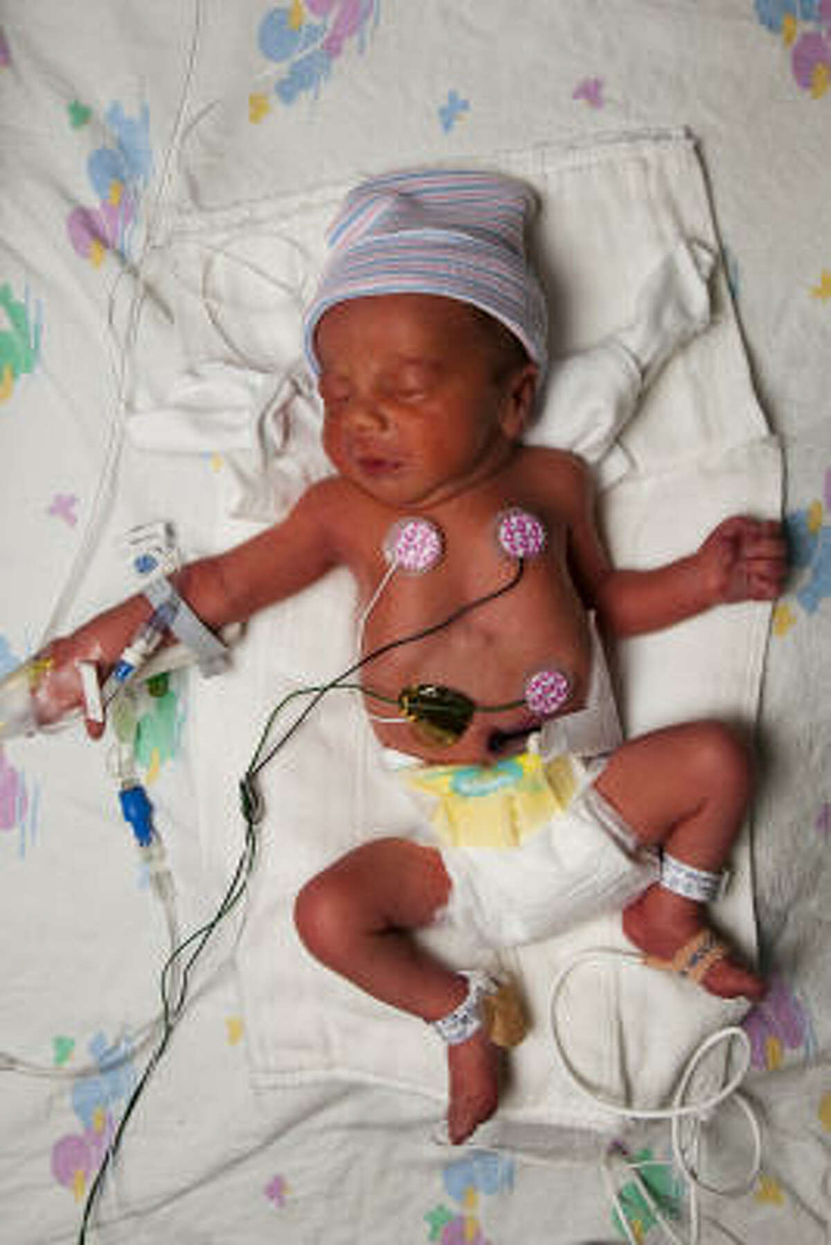 Carter Edward Lacombe photographed after three sets of baby triplets were born at The Woman's Hospital of Texas.