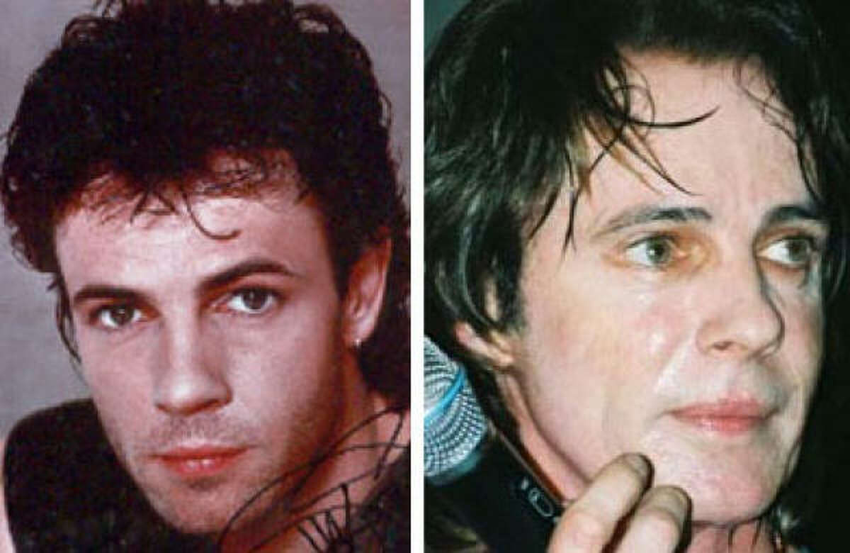Former '80s rocker and soap opera heartthrob Rick Springfield's mouth has taken on a new look after collagen injections and other procedures.