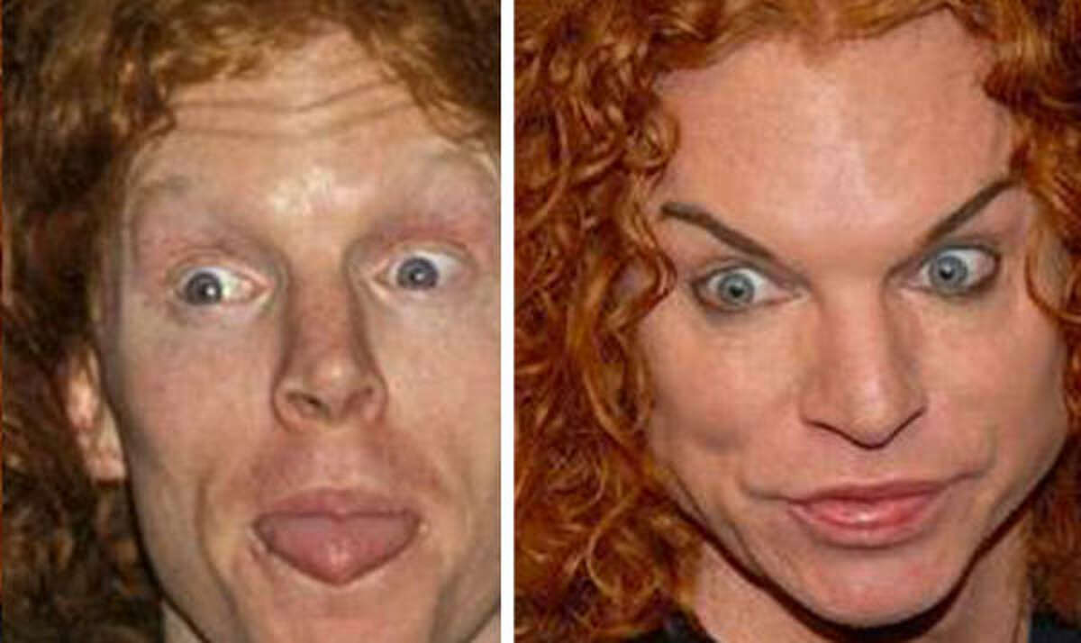 Comedian Carrot Top, not an especially attractive man in his "before" image, is just plain scary afterward.
