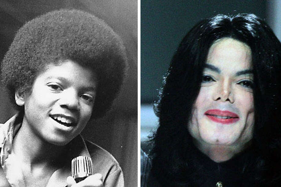 Как выглядел майкл джексон до операции фото до и после