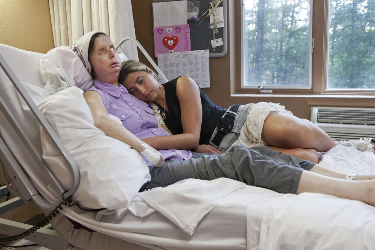 Charla Nash with her daughter Briana Nash in a rehabilitation center near Boston. Charla Nash lost her eyes, hands and much of her face on February 16, 2009 when attacked by a 200 pound chimpanzee at a friend's house in Stamford, Conn. In June 2011, at Brigham and Women's Hospital Department of Plastic Surgery's Charla underwent the groundbreaking fourth face transplant.