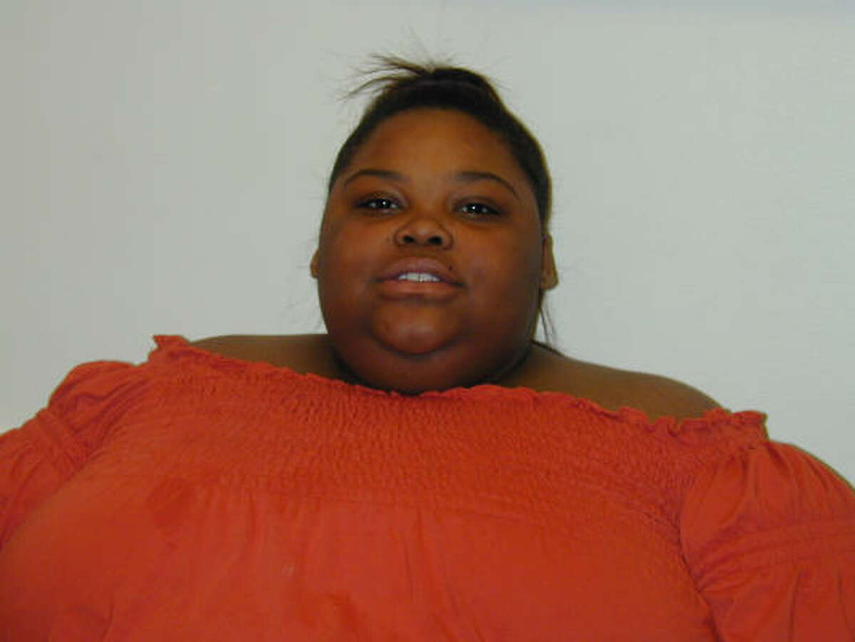 As part of Texas Children's Hospital's weight-loss program, KeAira Willis had bariatric bypass surgery last year and dropped from a peak of 370 pounds to her current 170 pounds.