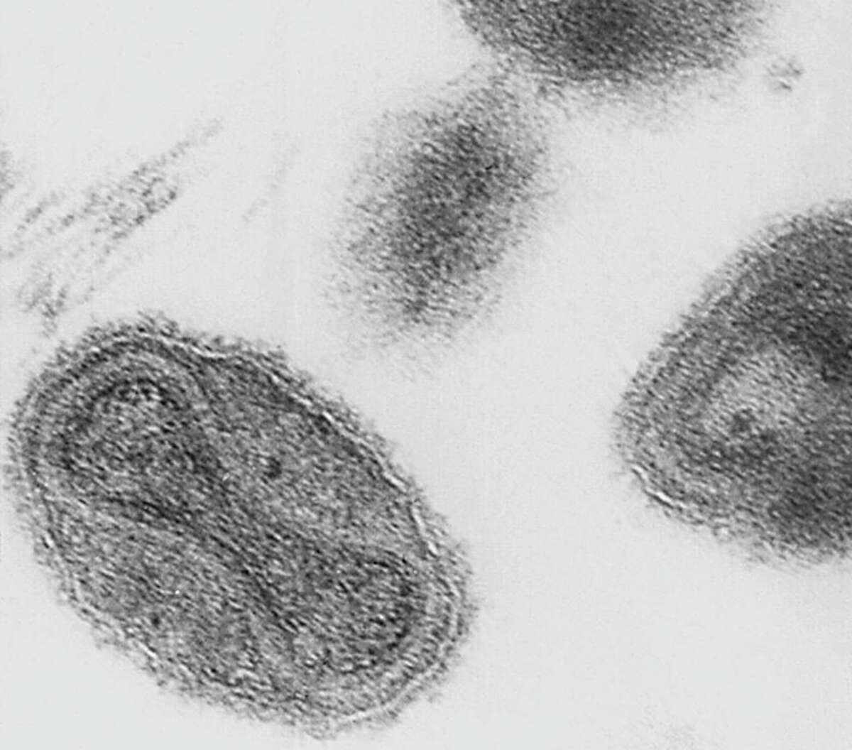 11 Myths Everyone Believes