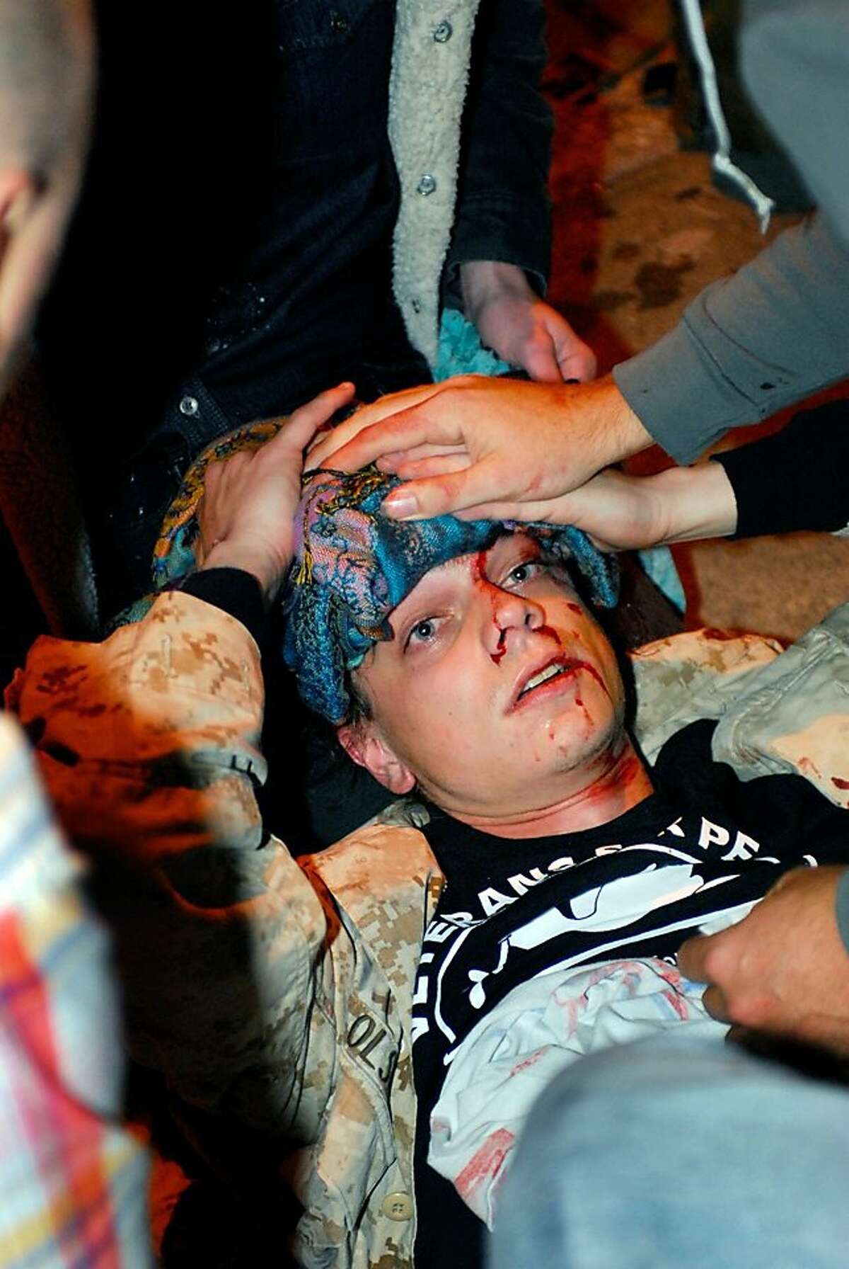 In this Oct. 25, 2011 photo, 24-year-old Iraq War veteran Scott Olsen lies on the ground bleeding from a head wound after being struck by a projectile during an Occupy Wall Street protest in Oakland, Calif. Olsen suffered a fractured skull while marching with other protesters attempting to reestablish a presence in the area of the disbanded camp, said Dottie Guy, of the Iraq Veterans Against the War. Police Chief Howard Jordan says an internal review board and local prosecutors have been asked to determine if officers on the scene used excessive force. (AP Photo/Jay Finneburgh) Ran on: 10-28-2011 Other protesters aid Olsen after he was hurt. Ran on: 10-28-2011 Other protesters aid Olsen after he was hurt.