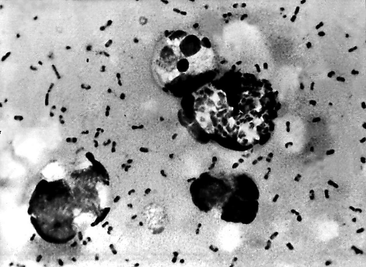 This Centers For Disease Control (CDC) file image obtained 15 January, 2003, shows the bubonic plague bacteria taken from a patient. A South Lake Tahoe resident has tested positive for the human plague, the first case in California in five years.
