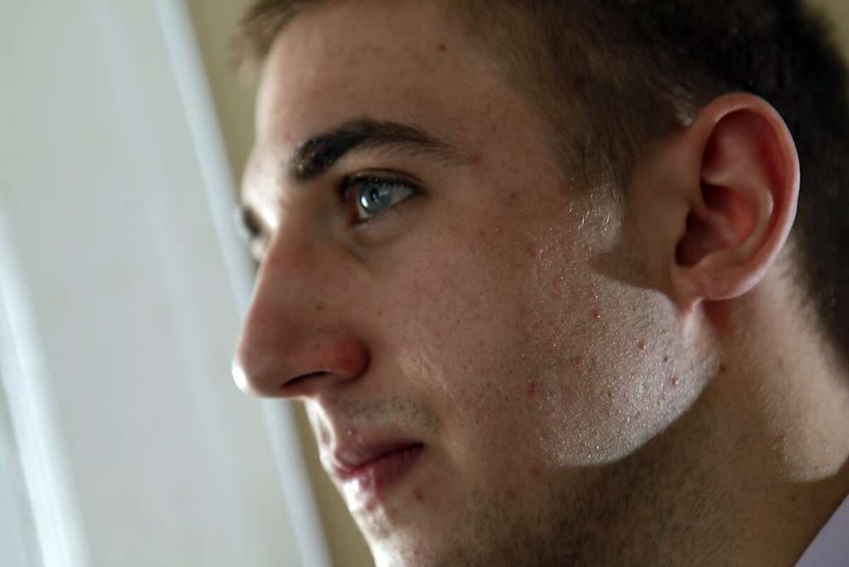 Colton Tidwell of Oakland, Calif., shows his repaired ear lobes on Monday, January 2, 2012, that were surgically reconstructed by Dr. David Kahn. Tidwell used to have disc earrings for years and decided to have the lobes repaired for various reasons. Since his surgery, Tidwell has gotten a new job at a bank and is glad he had the surgery done.