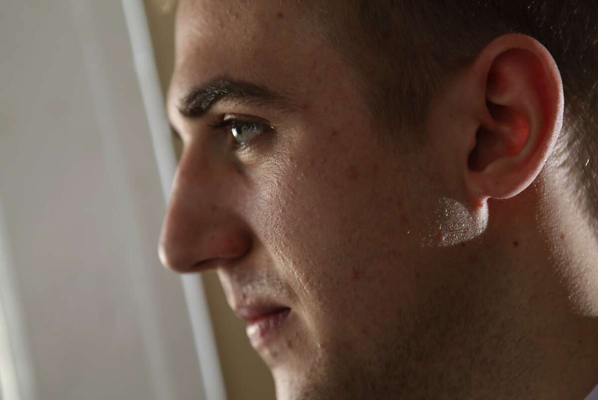 Colton Tidwell of Oakland, Calif., shows his repaired ear lobes on Monday, January 2, 2012, that were surgically reconstructed by Dr. David Kahn. Tidwell used to have disc earrings for years and decided to have the lobes repaired for various reasons. Since his surgery, Tidwell has gotten a new job at a bank and is glad he had the surgery done.