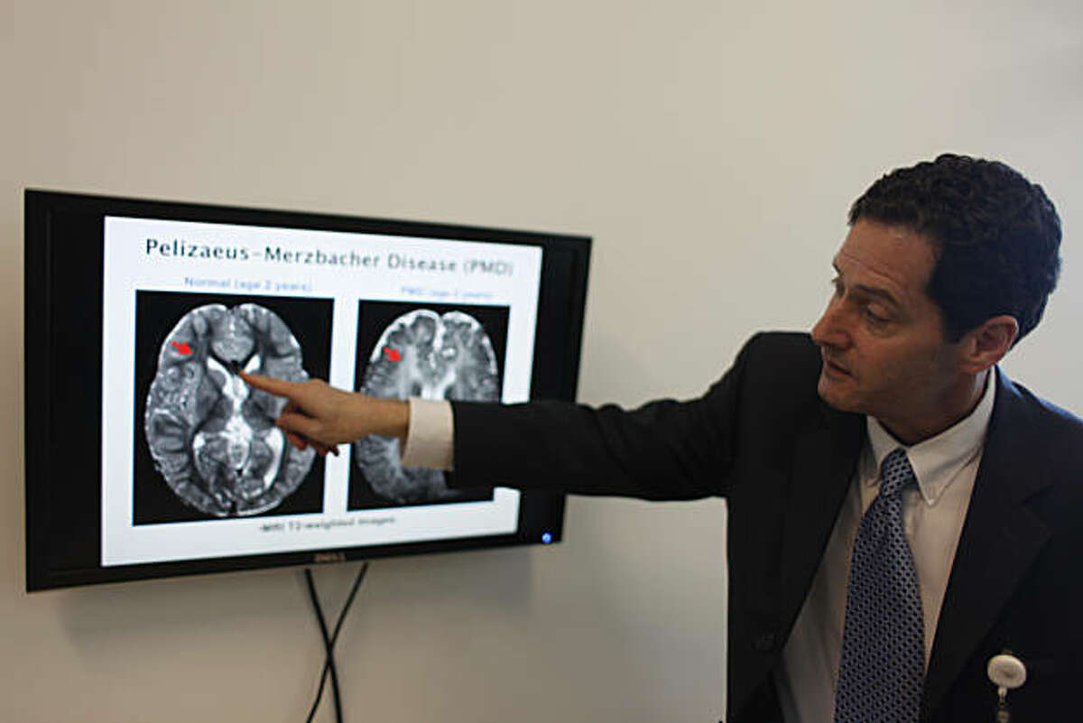 Dr. David Rowitch, UCSF pediatrician and neurological surgeon, talks about the stem cell trial he's conducting in his office in the Ray and Dagmar Dolby Regeneration Medicine Building at USCF using a screen to display images on Monday, February 4, 2011 in San Francisco, Calif.