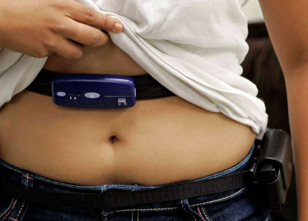 FILE - In this Thursday, Sept. 17, 2009 file photo, a 15-year-old girl has her sensor checked before starting a series of physical activities at a University of Southern California lab in Alhambra, Calif. A cell phone for gathering the data is attached to a belt on her hip. America's obesity epidemic is proving to be as stubborn as those maddening love handles, and shows no sign of reversing course. More than one-third of adults and almost 17 percent of children were obese in 2009-10, echoing results since 2003, the Centers for Disease Control and Prevention reported Tuesday, Jan, 17, 2012.