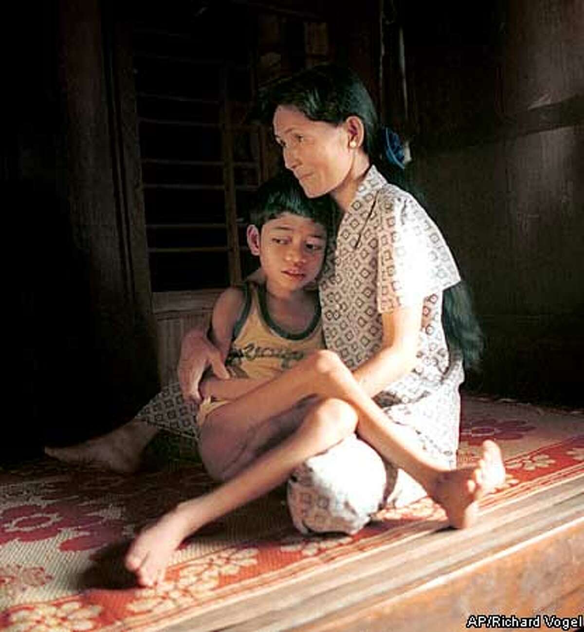 FOR USE WITH FEATURE TITLED 12-year-old Pham Quoc Huy is comforted by his mother on a bamboo cot in their home, Feb. 19, 2000, near his village of Dong Son, in the A Luoi valley of the Central Highlands, Vietnam. Pham is suffering from what his parents say are the effects of the jungle defolinat, Agent Orange, used heavily in the region by the U.S. armed forces during the Vietnam War. (AP Photo/Richard Vogel)