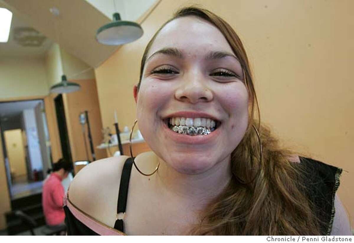 GOLDTEETH131PG.JPG Mica Castro shows off her gold teeth. High school girls get gold teeth for their prom from the Gold Tooth Master. The San Francisco Chronicle, Penni Gladstone Photo taken on 4/15/05, in Oakland,