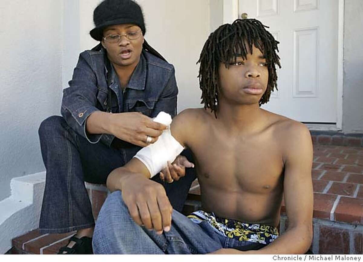 MCCULLOUGH01_040_MJM.jpg Stacy Hegler helps wrap the dressing covering the gunshot wound in her son Melvin McHenry's arm. Melvin McHenry is a 16 year old Oakland kid who was shot on 59th and Shattuck recently. His mother, Stacy Hegler said her son is not drug dealer as the shooter Patrick McCullough claims and was merely acting in self defense. She thinks that Patrick McCullough should be prosecuted "for shooting my son." So far, the Oakland cops back McCullough. Photo by Michael Maloney / San Francisco Chronicle MANDATORY CREDIT FOR PHOTOG AND SF CHRONICLE/ -MAGS OUT