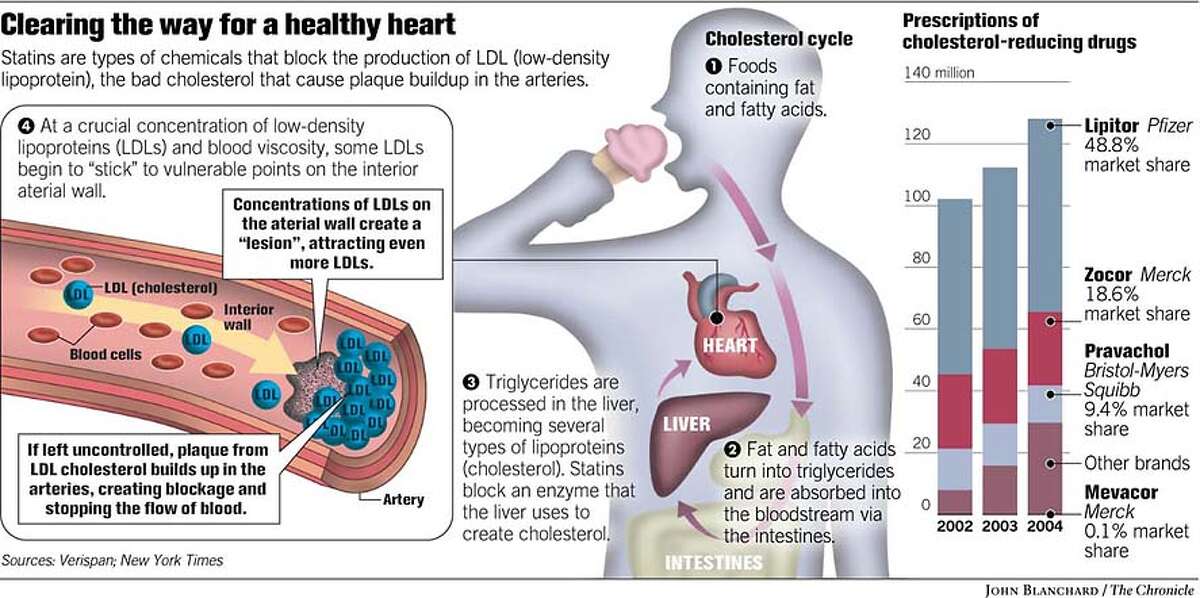 Clearing the Way for A Healthy Heart. Chronicle graphic by John Blanchard