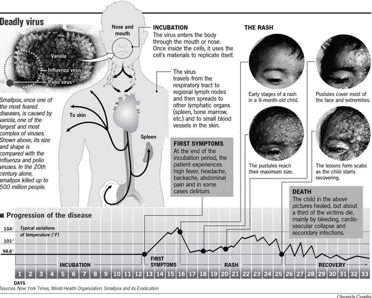 Taking stock of smallpox viruses / Public health experts divided on