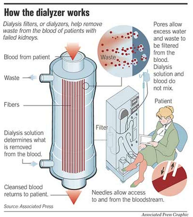 soaring-demand-for-dialysis-as-hypertension-and-diabetes-numbers-rise