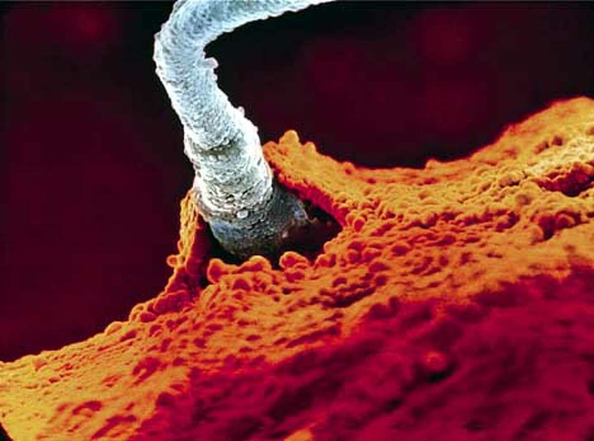 Sperm problems tied to death in near future, study finds