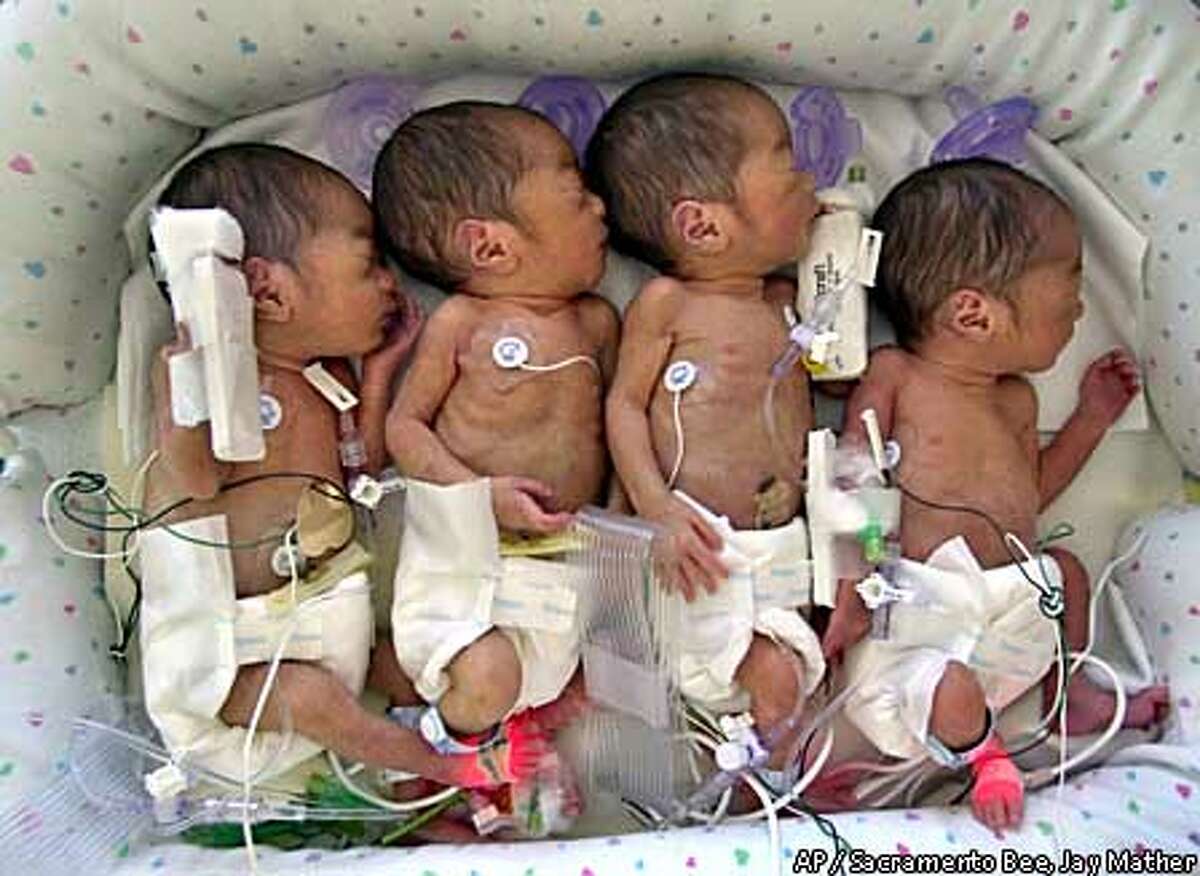 Identical Quadruplets Born All 4 Baby Girls Doing Fine In Sacramento Hospital