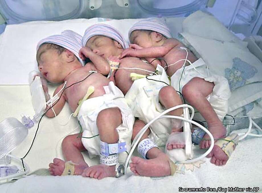 4 of a kind / Rare identical quads born in Sacramento SFGate