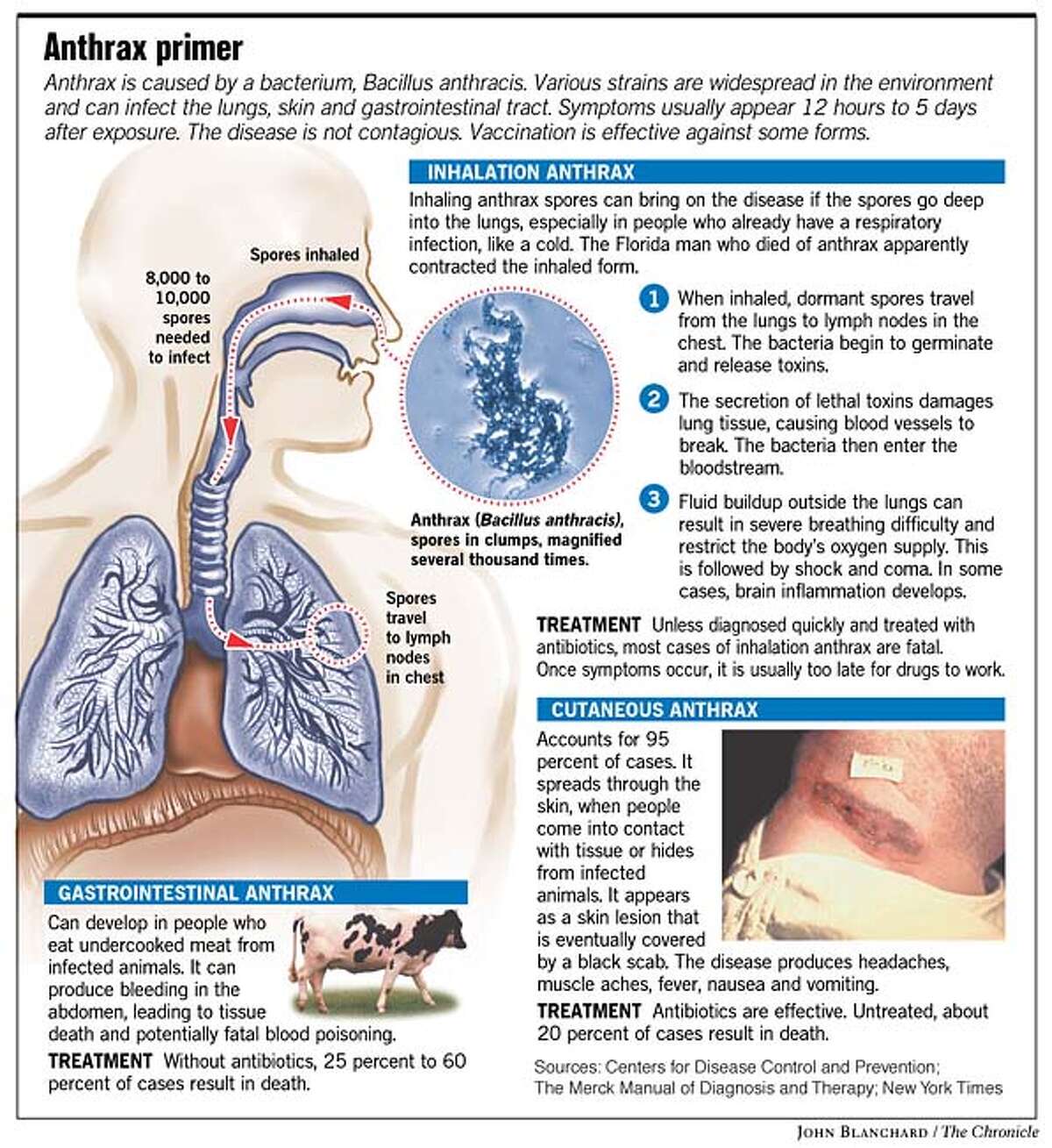 Fear Of Anthrax Rattles Nation New Case Reported In N Y Hundreds   1200x0 