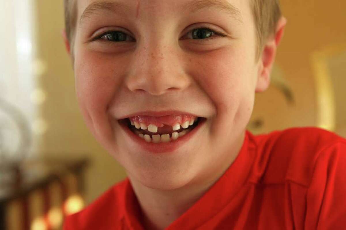  Blake Johnson, 6, had a very loose front tooth pulled during his six-month checkup at the dentist.