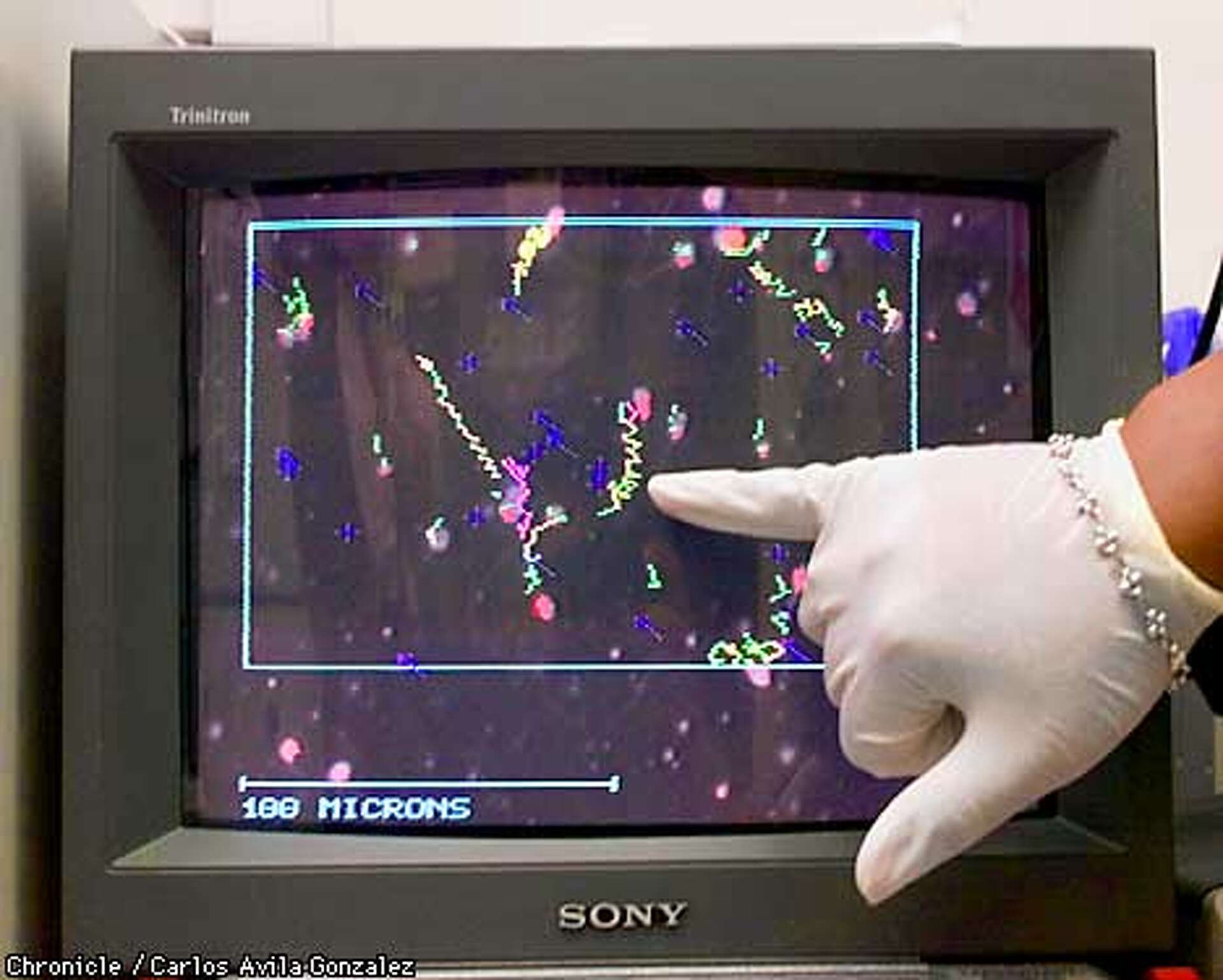The forgotten embryo / Fertility clinics must store or destroy the ...