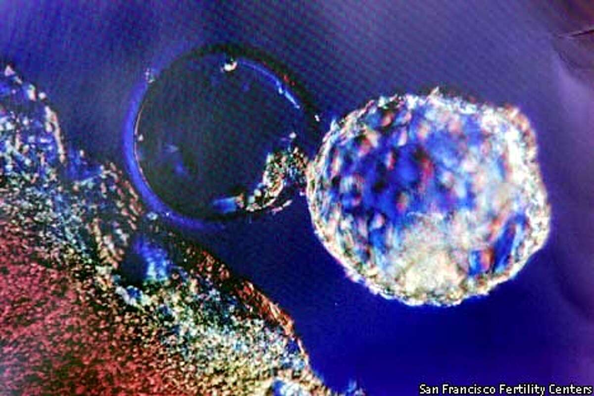 The embryo / Fertility clinics must store or destroy the