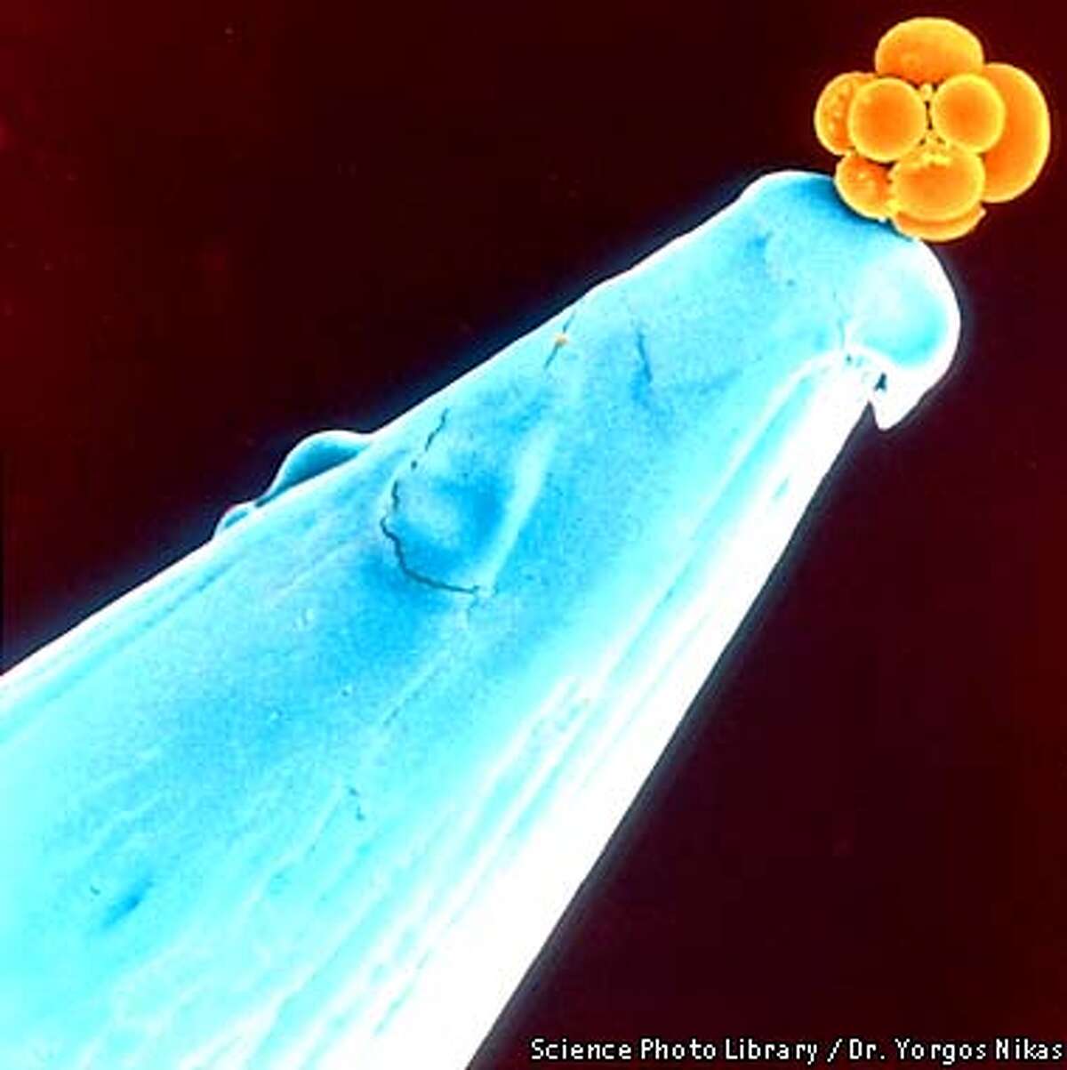 Seeds of possibility / The debate over using stem cells harvested from