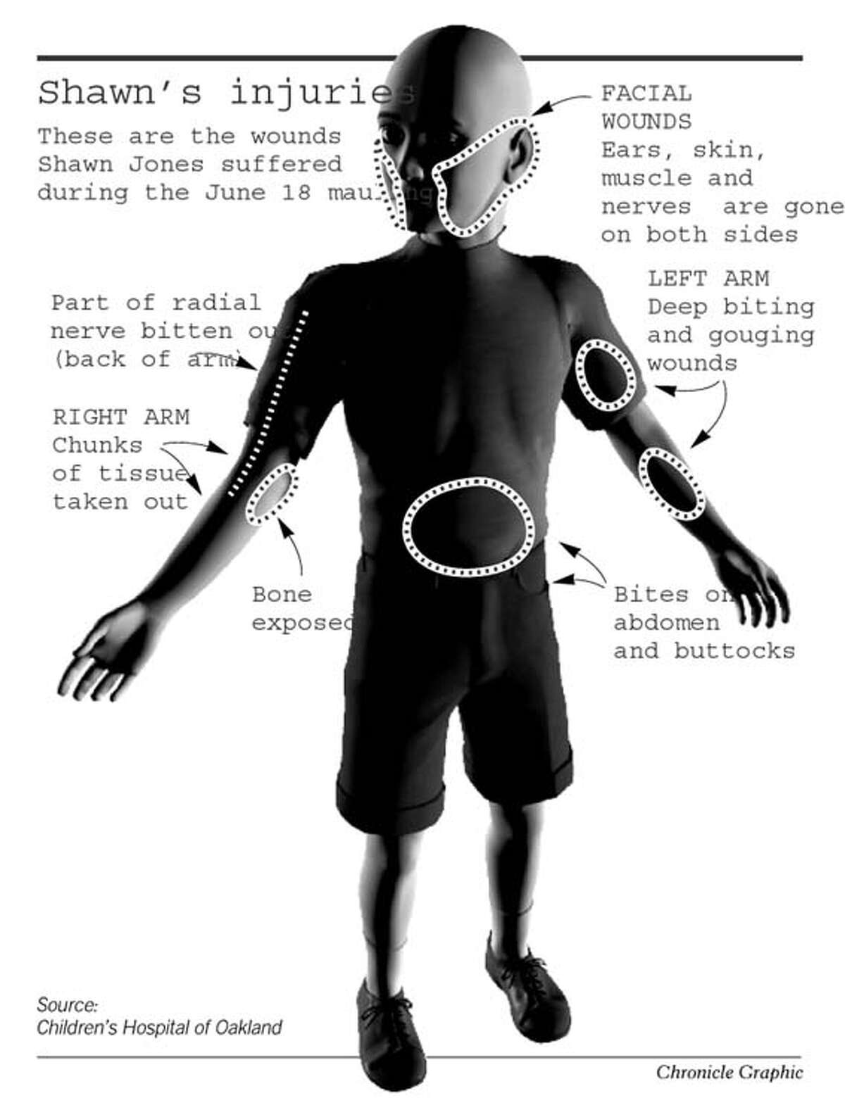 Shawn's long journey back from death's door / Surviving pit bull