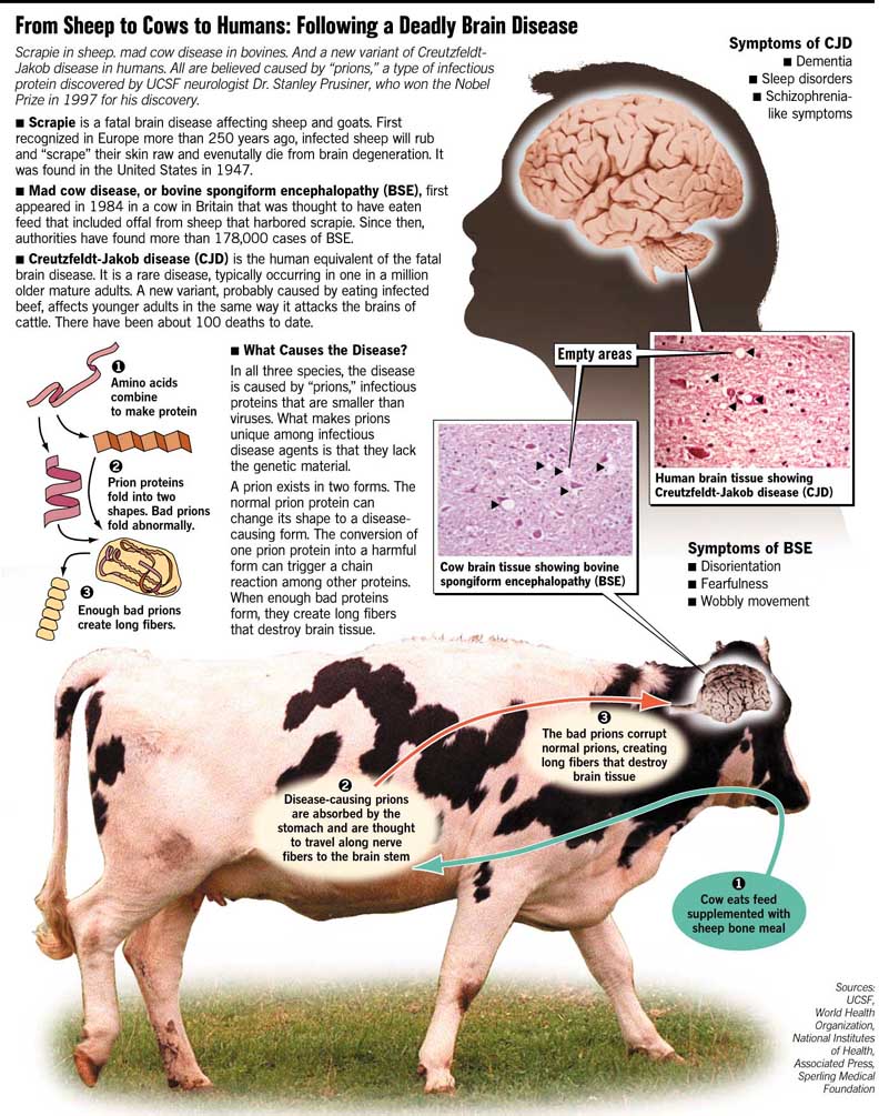 mad cow disease in humans brain