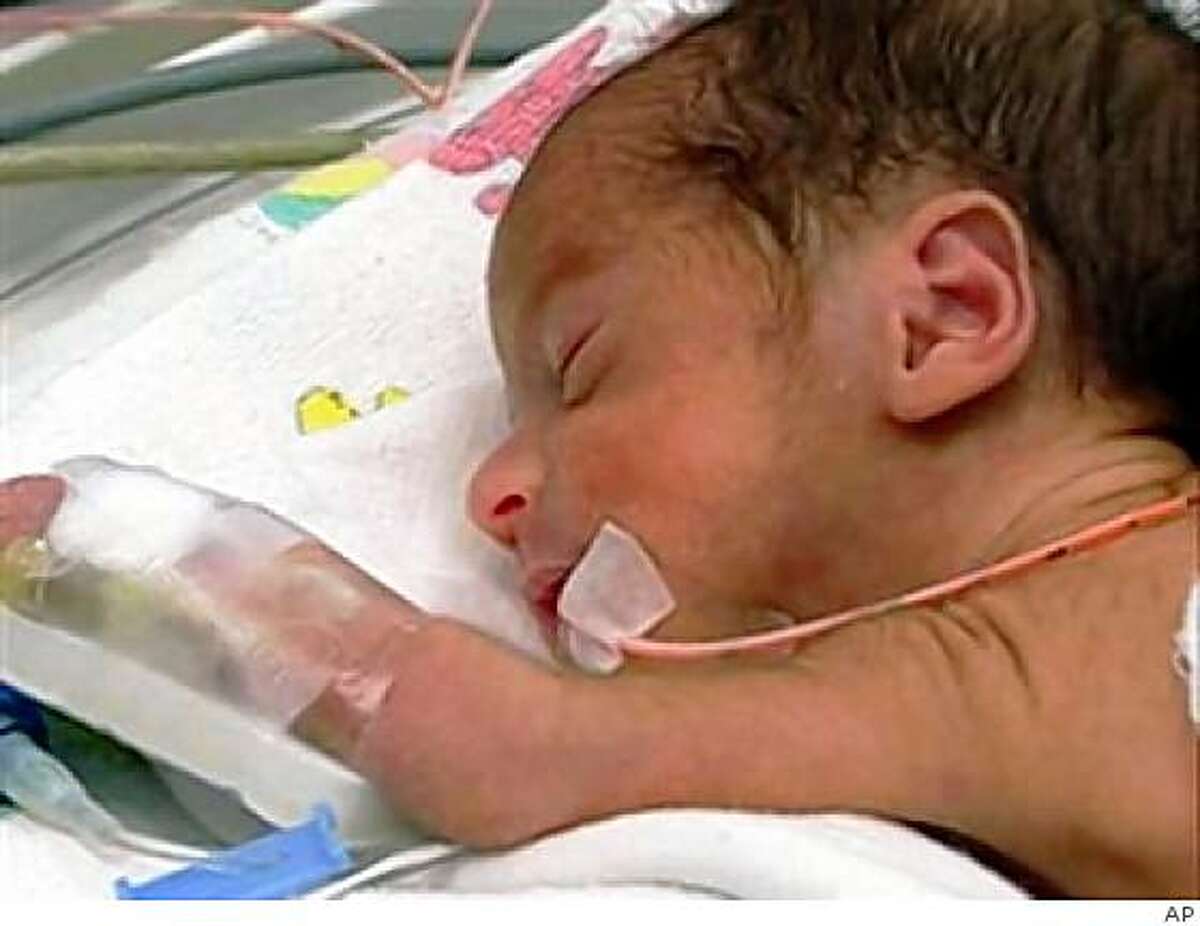 Octubplets Taxpayers may bear cost of raising octuplets