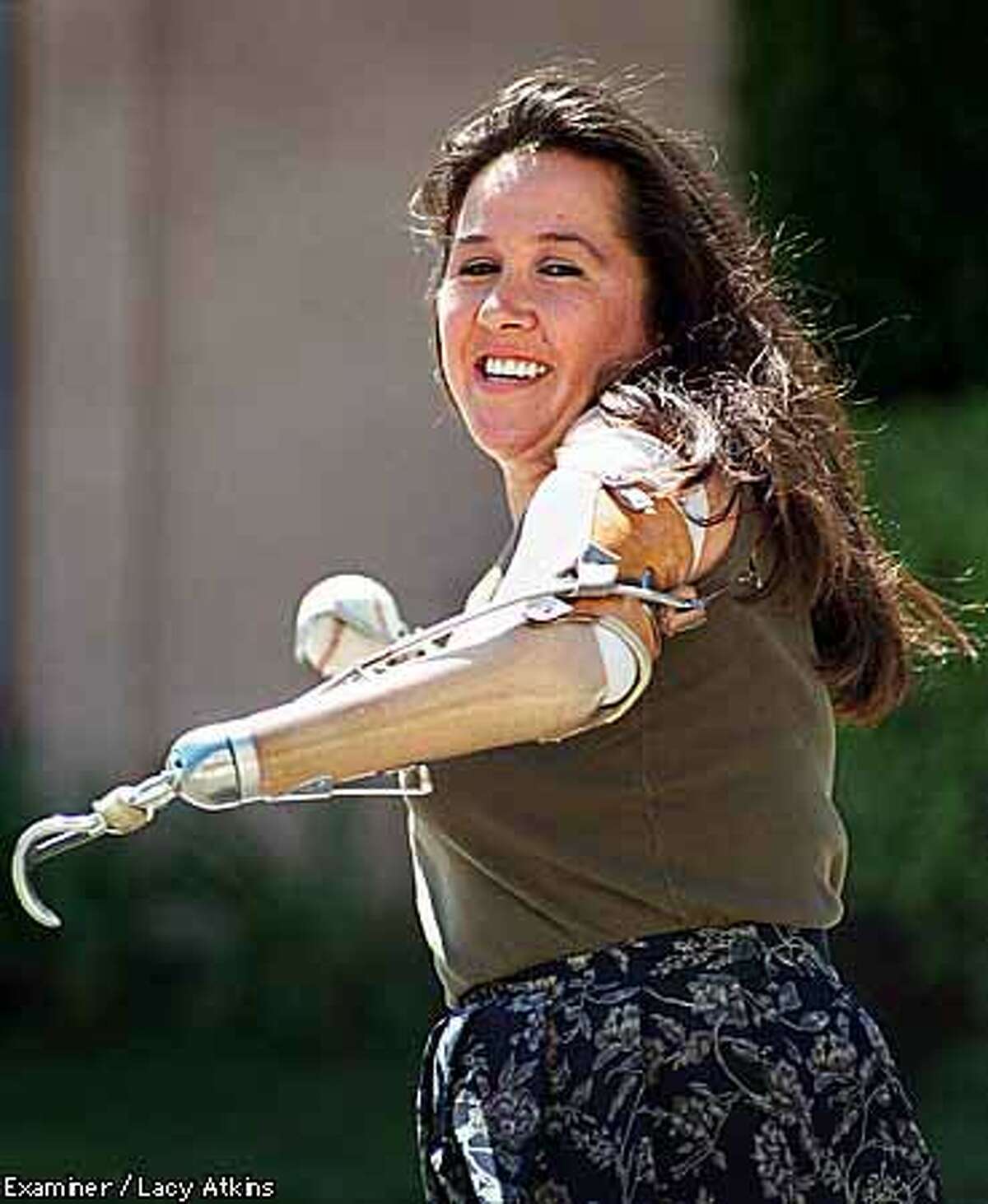 From basket case to wonder woman